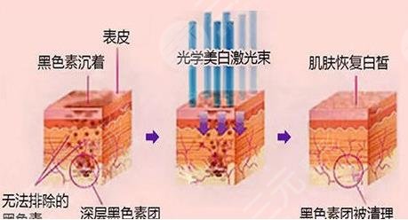 皮肤毛孔大敷面膜果好吗?