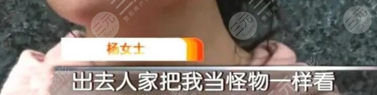 女子整容失败崩溃大哭