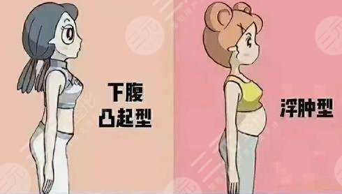 小肚子大是什么原因?