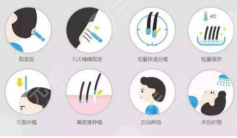 植发过程原理