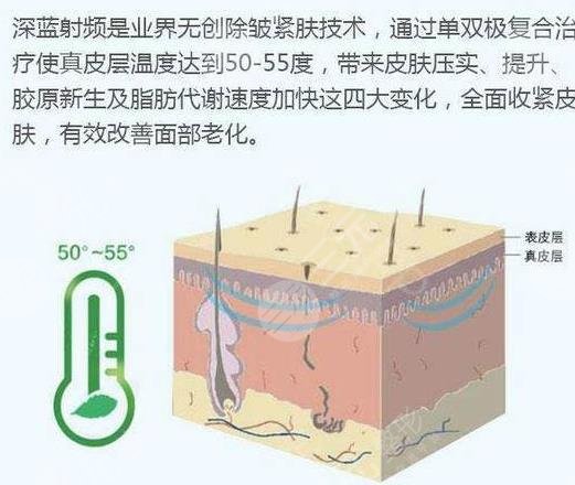 消除妊娠纹的方法有哪些?