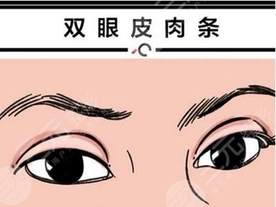 双眼皮手术果