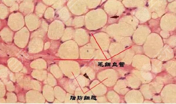 全脸脂肪填充有什么优点