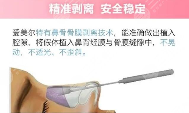 美迪菲假体和韩式生科哪个好?哪个贵?美迪菲假体