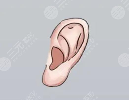 后天性耳廓缺损