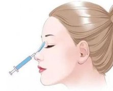 鼻子填充玻尿酸能维持多久呢？注意这3点，让注射美鼻伴你更久！