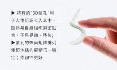 超体隆鼻和膨体哪个好?优点分析