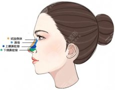 二次修复鼻子膨体要换吗？科普小知识＋案例分享，快进来做笔记吧！