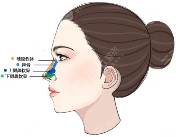 十个做鼻子九个后悔真的吗