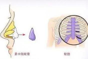 上海刘名成做鼻子案例一览