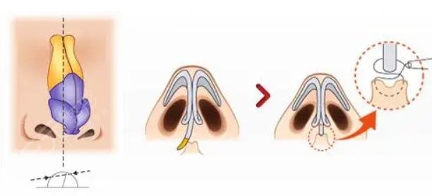 鼻部基础性