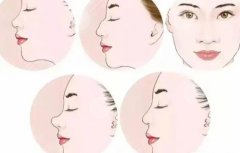 肋骨隆鼻三个月变化图|网友鼻子整形日记分享:肿胀过后迎接精美翘鼻！
