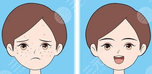 花都人民医院激光多少钱