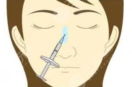 注射隆鼻