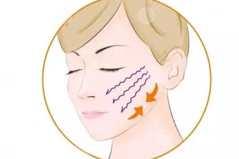 哪些因素影响脸部提拉手术费用