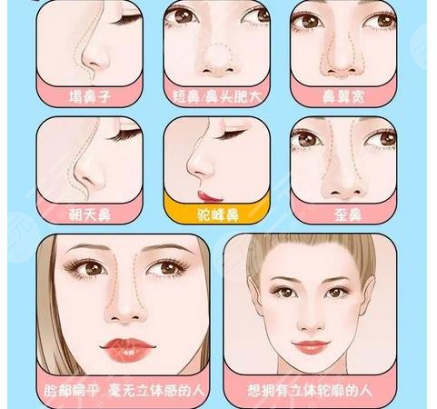 好还是单纯隆鼻好?各优势解读?