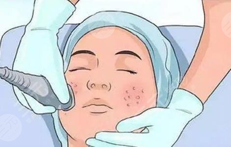 江门市中心医院点阵激光怎么样