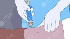 贵州省人民医院可以抽脂吗?医院设备正规齐全、抽脂手术必看!案例果图直出~ 贵州省人民医院可以抽脂吗?医院设备正规齐全、抽脂手术必看!案例果图直出~