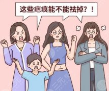 佛山第一人民医院美容科治疤痕怎么样？激光祛疤术后反馈送达，附价格表和医院介绍！