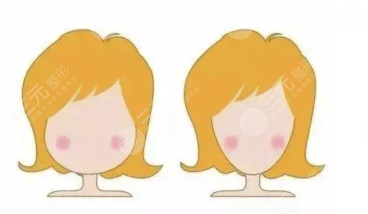 进行下颚骨手术的注意事项