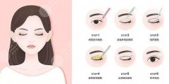 中山三院割双眼皮果好吗？果图直出|医生介绍|价目表