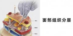 拉皮是怎么做的？拉皮手术科普&医院选择指南一份！速查收~