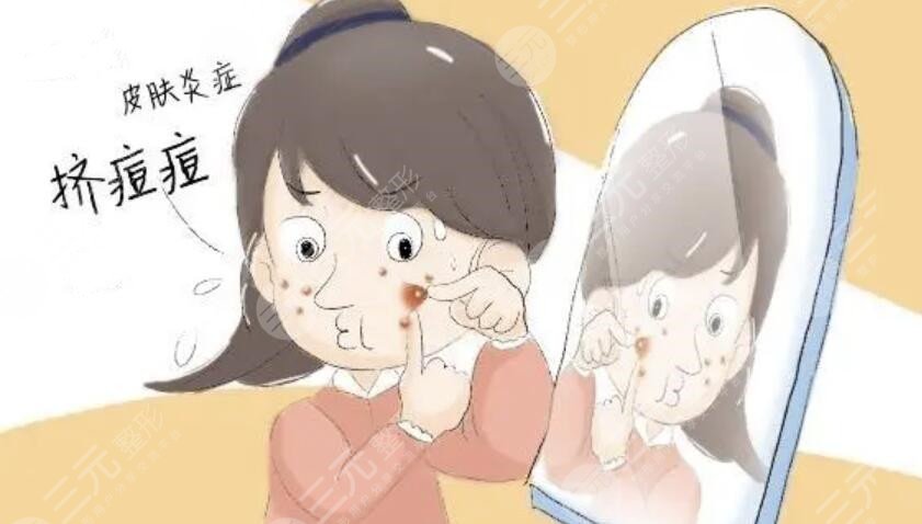 痤疮粉刺的缓解方法有几种?