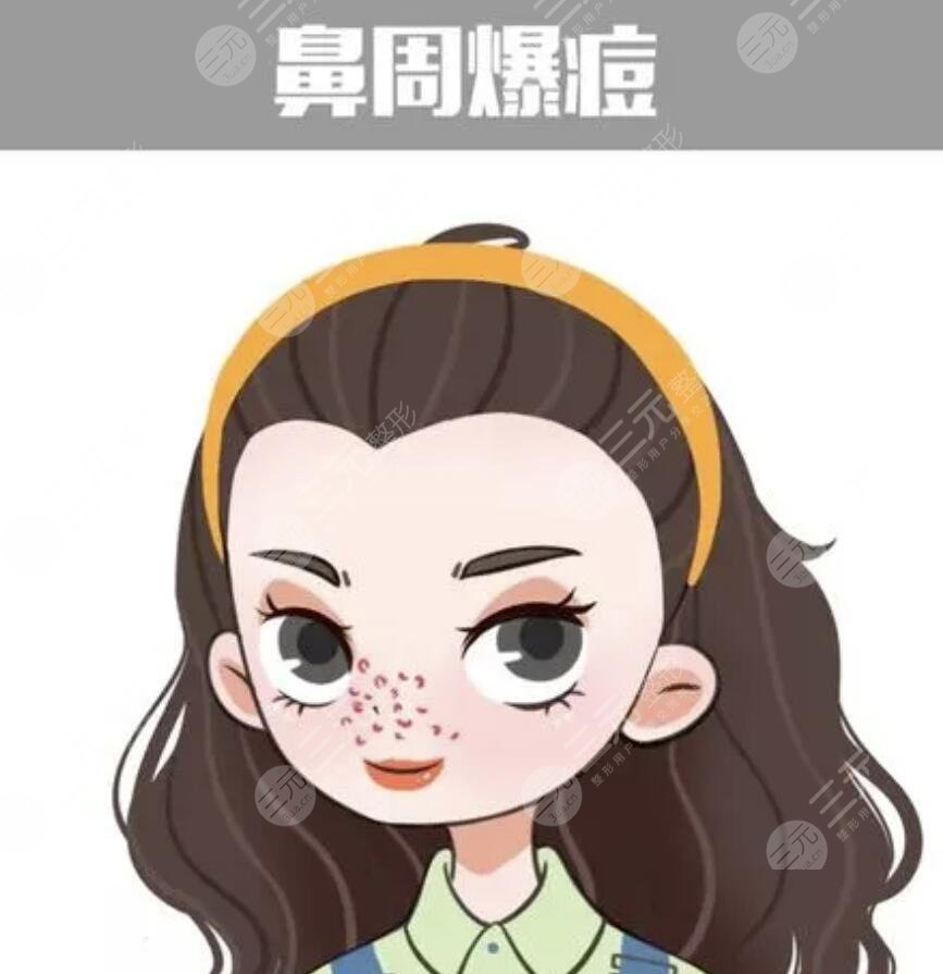 鼻子上长痘痘的原因有哪些?