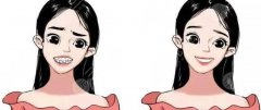 汉中市中心医院牙齿正畸的技术好吗？医院正规、技术审美都在线！详细信息值得收藏~