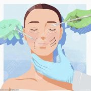 美瞳线恢复过程图更新啦！详细医院信息整理&术后案例分享 选对医院、一键变美~