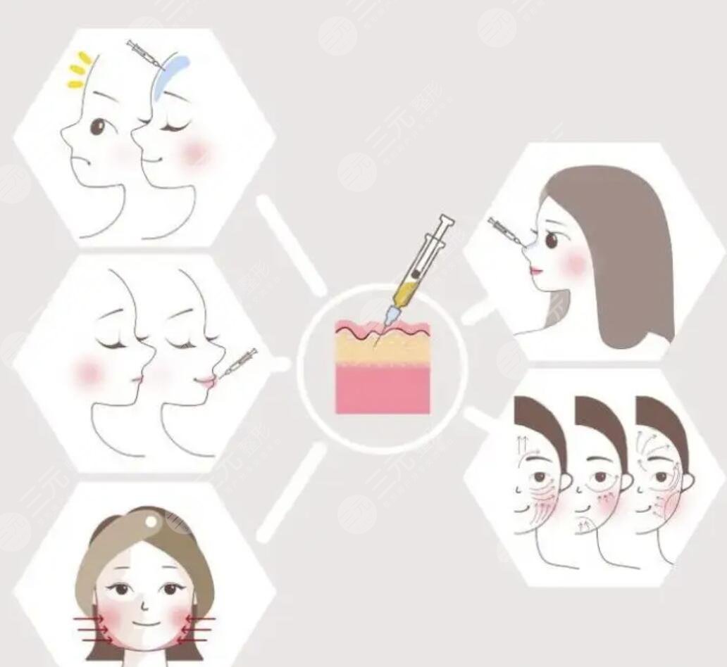 *玻尿酸注射后如何养护皮肤果维持时间长？