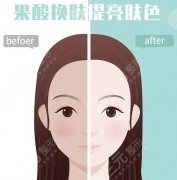 果酸换肤前后对比照片更新啦！肌肤洁净如新、展现不一样的美~