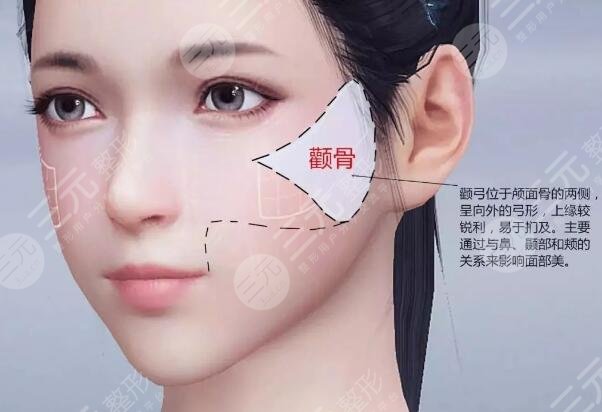 颧骨高怎么才能改良