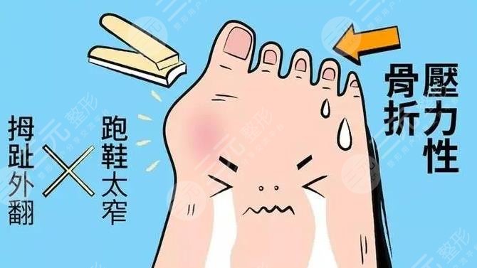 马桂文大脚骨手术靠谱吗