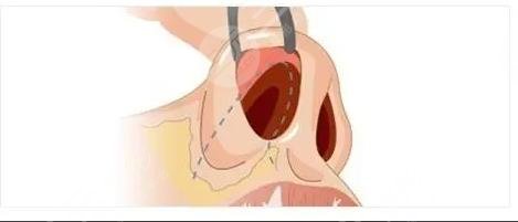 北京画美医院马群医生怎么样？口碑简介_擅长项目等在线一览！术前必看~