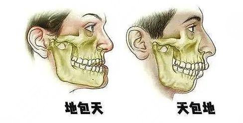 天包地矫正后脸型变化图