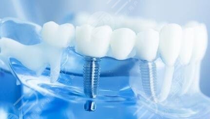 北京中诺口腔医院科普知识