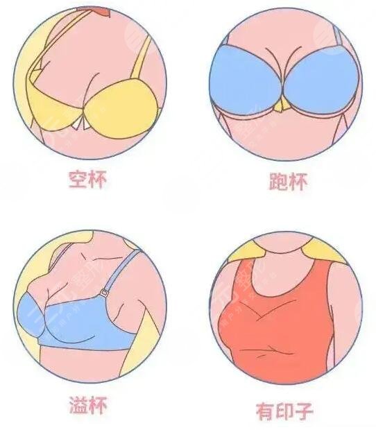 哪种丰胸方法比较好?