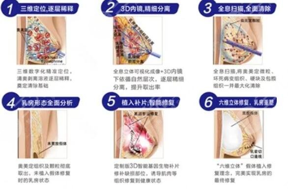 去奥美定选择的医院不同价格也就不同