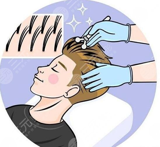 头发种植大概需要多久能恢复?