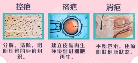 上海九院激光祛疤手术介绍