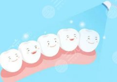 冷光美白牙齿有什么危害？多少钱一次？美牙攻略速看~