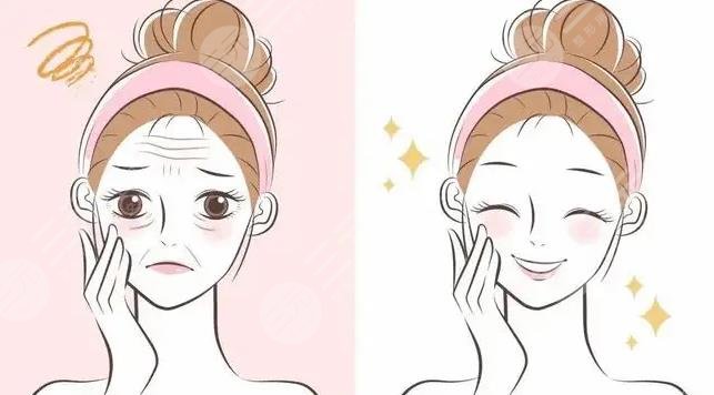 卢建建面部微调怎么样