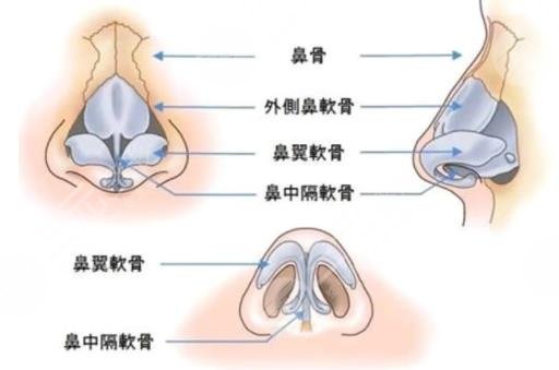 隆鼻