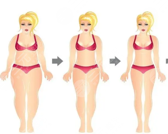 宜昌中心医院抽脂案例分享：