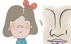 濡白天使隆鼻维持多久？注射之前有讲究！这3家医院来看看！
