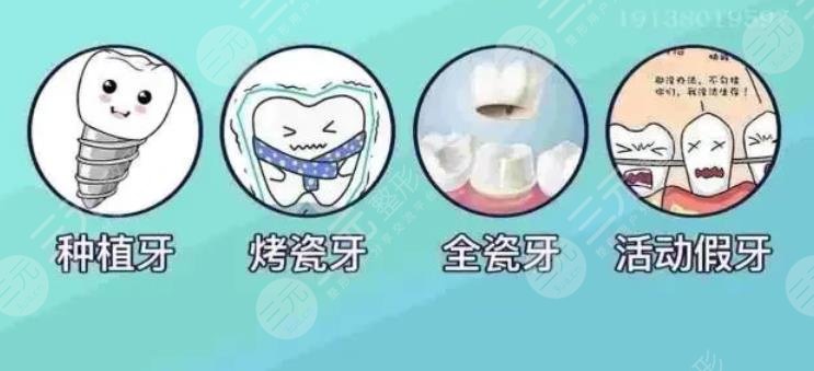 了解南方医科大学深圳医院种植牙价格?