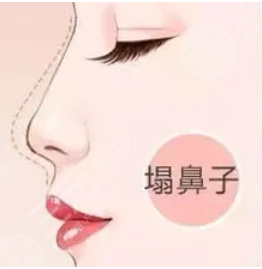 北京大学深圳医院隆鼻做的好吗
