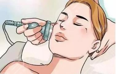 河北省二院点阵激光案例分享