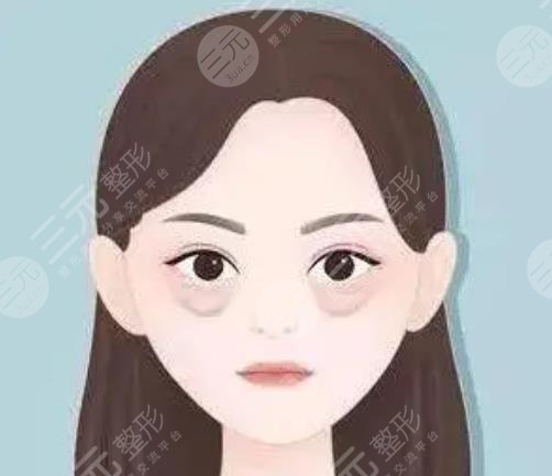 宝安区人民医院整形科去眼袋案例分享